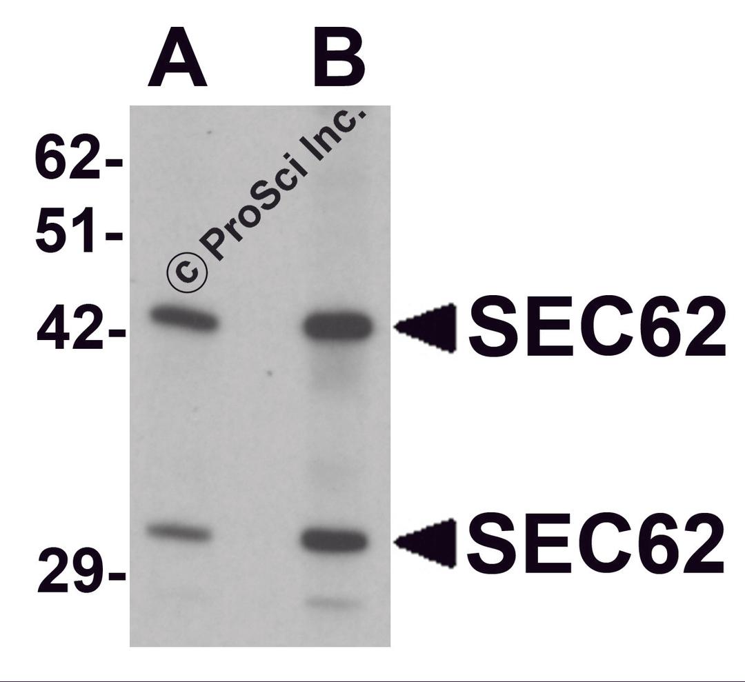 Western blot analysis of SEC62 in rat brain tissue lysate with SEC62 antibody at (A) 0.5 and (B) 1 &#956;g/mL.