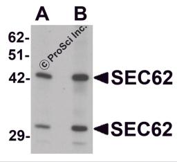 Western blot analysis of SEC62 in rat brain tissue lysate with SEC62 antibody at (A) 0.5 and (B) 1 &#956;g/mL.