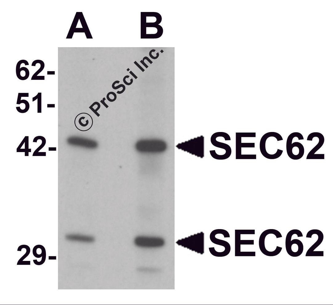 Western blot analysis of SEC62 in rat brain tissue lysate with SEC62 antibody at (A) 0.5 and (B) 1 μg/mL.