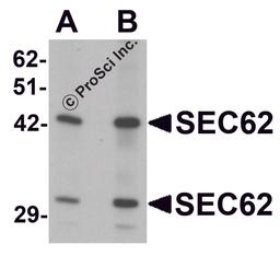 Western blot analysis of SEC62 in rat brain tissue lysate with SEC62 antibody at (A) 0.5 and (B) 1 μg/mL.