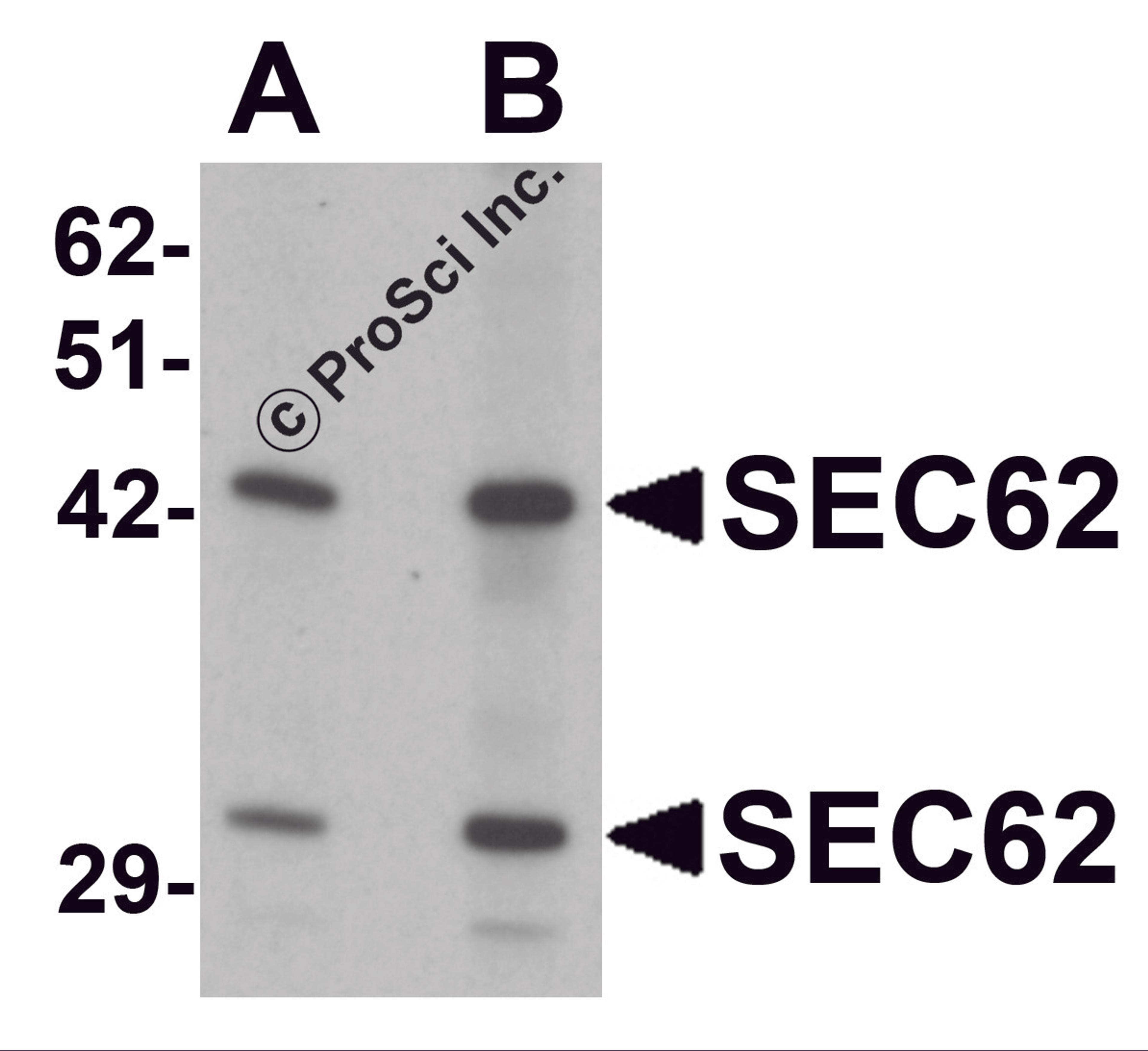 Western blot analysis of SEC62 in rat brain tissue lysate with SEC62 antibody at (A) 0.5 and (B) 1 μg/mL.