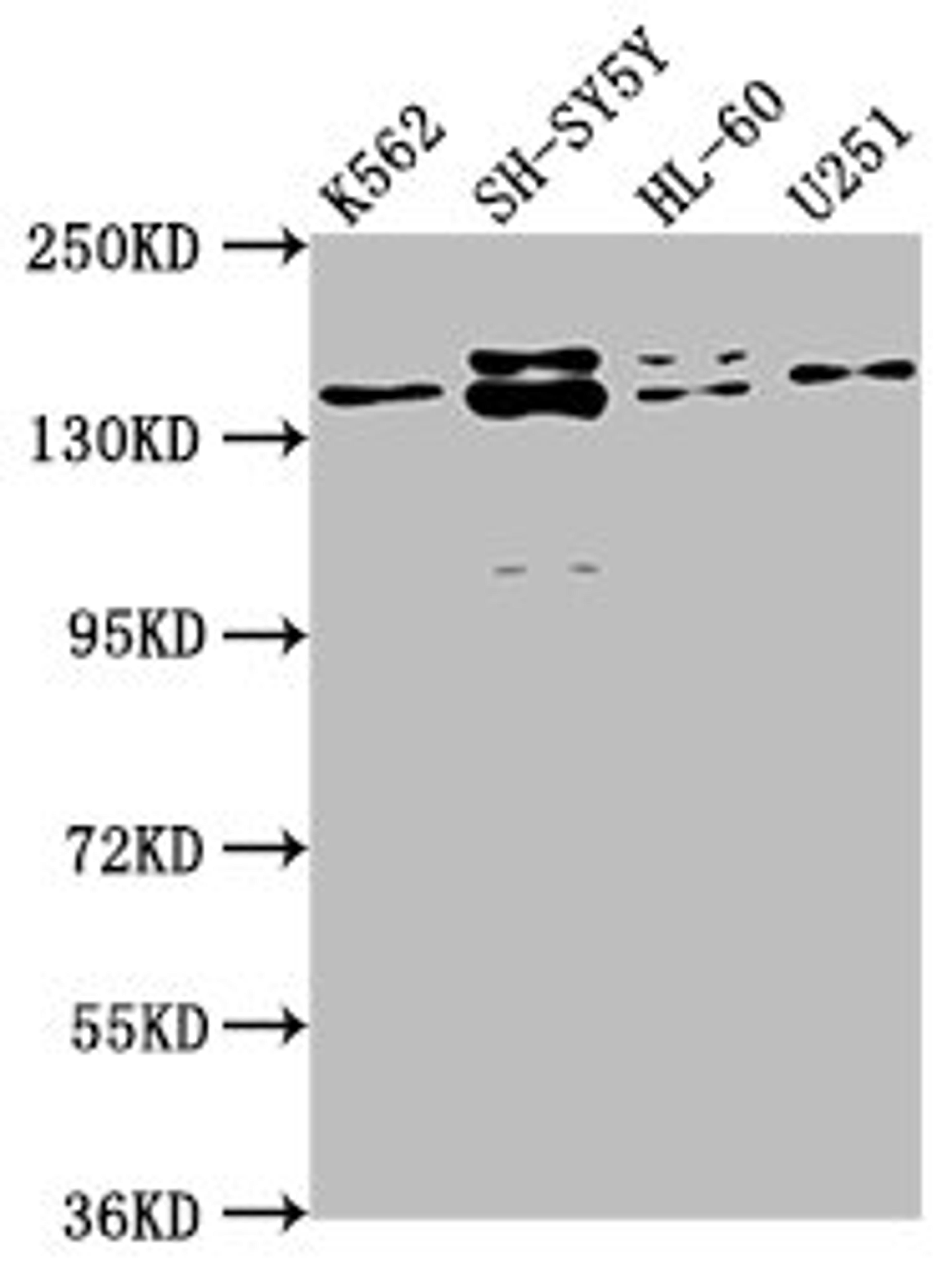 Western Blot. Positive WB detected in: K562 whole cell lysate, SH-SY5Y whole cell lysate, HL-60 whole cell lysate, U251 whole cell lysate. All lanes: AHI1 antibody at 1:2000. Secondary. Goat polyclonal to rabbit IgG at 1/50000 dilution. Predicted band size: 138, 121, 71 kDa. Observed band size: 138 kDa.