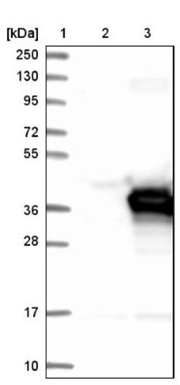 Western Blot: PECR Antibody [NBP1-83198] - Lane 1: Marker [kDa] 250, 130, 95, 72, 55, 36, 28, 17, 10<br/>Lane 2: Negative control (vector only transfected HEK293T lysate)<br/>Lane 3: Over-expression lysate (Co-expressed with a C-terminal myc-DDK tag (~3.1 kDa) in mammalian HEK293T cells, LY413023)