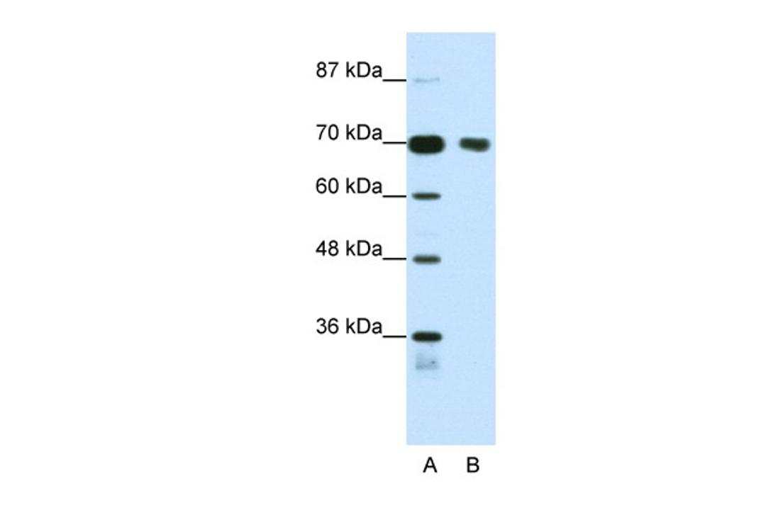 Antibody used in WB on Human Jurkat 1.25 ug/ml.