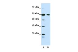 Antibody used in WB on Human Jurkat 1.25 ug/ml.