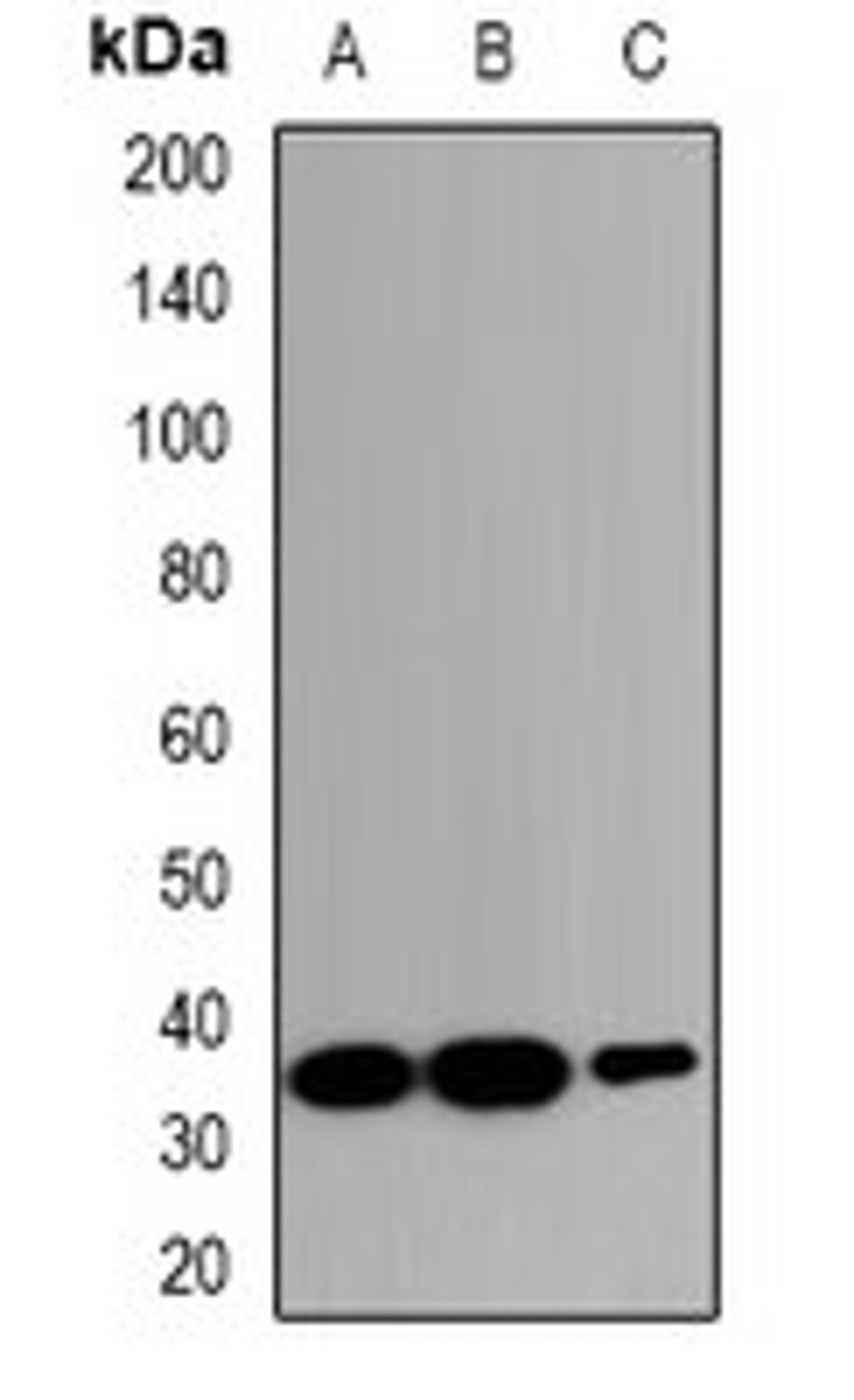 Western blot analysis of HeLa (Lane1), RAW264.7 (Lane2), PC12 (Lane3) whole cell lysates using SLC30A2 antibody