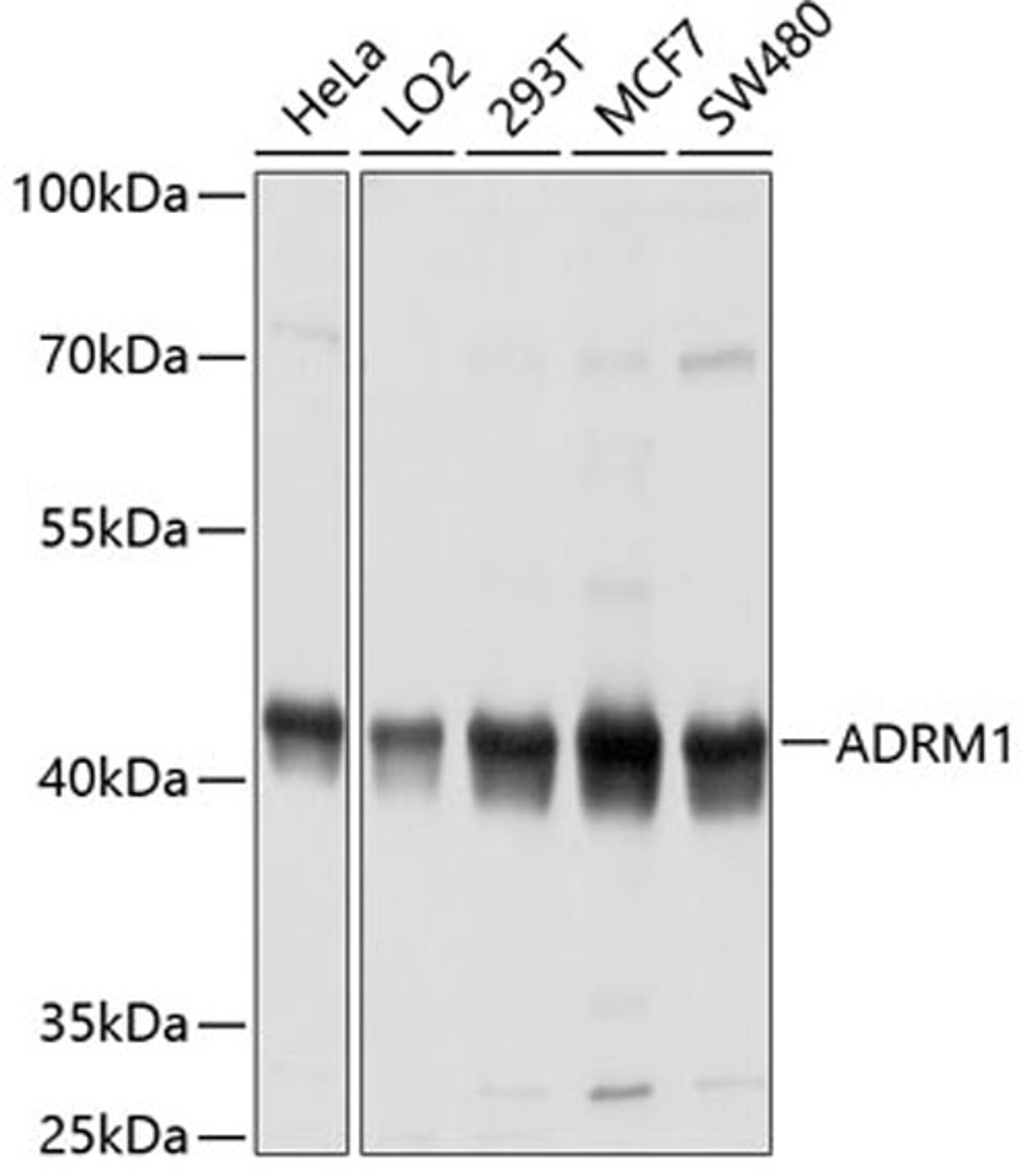 Western blot - ADRM1 antibody (A4481)