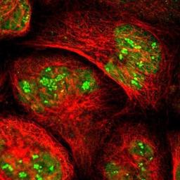 Immunocytochemistry/Immunofluorescence: USP28 Antibody [NBP1-82904] - 431 shows positivity in nucleus & nucleoli.