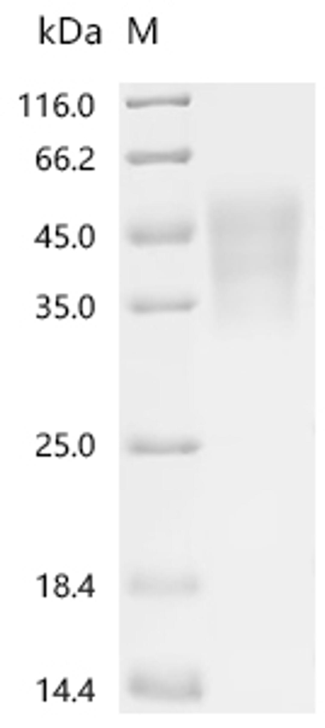 (Tris-Glycine gel) Discontinuous SDS-PAGE (reduced) with 5% enrichment gel and 15% separation gel.