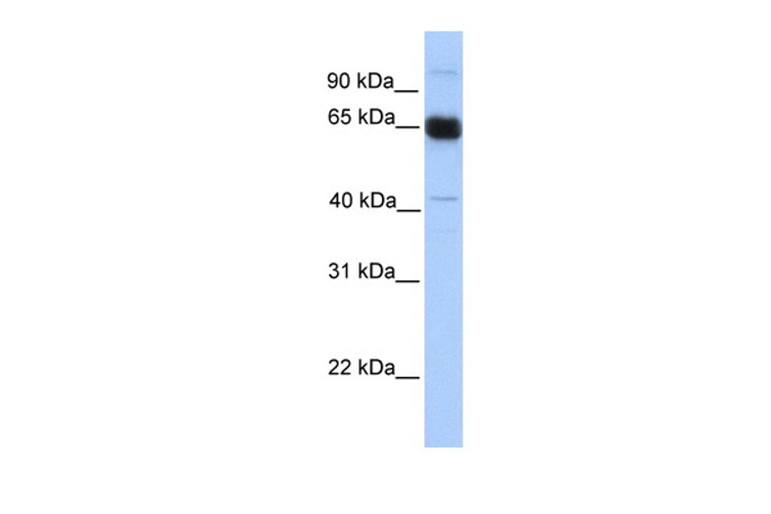 Antibody used in WB on Human Muscle at 0.2-1 ug/ml.