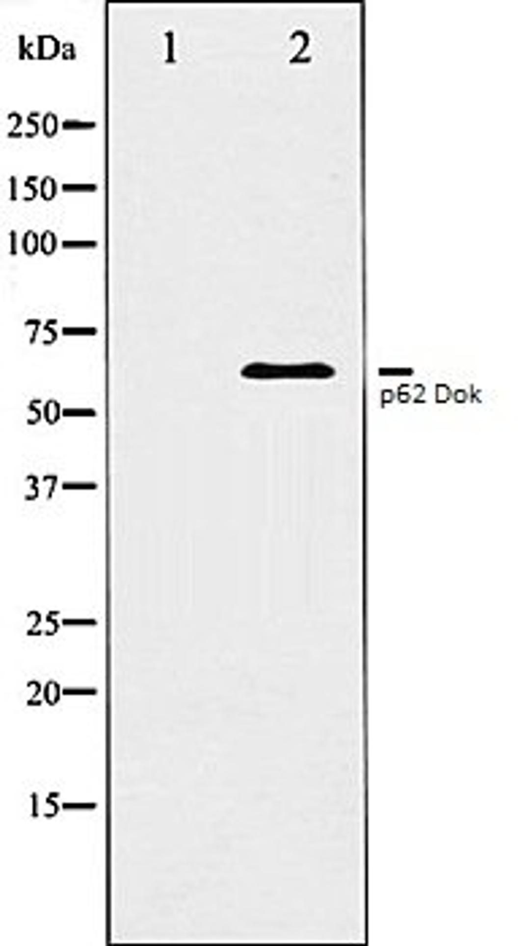 Western blot analysis of Jurkat whole cell lysates using p62 Dok antibody, The lane on the left is treated with the antigen-specific peptide.