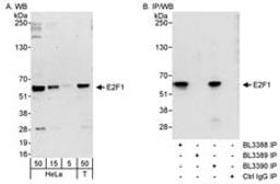 Detection of human E2F1 by western blot and immunoprecipitation.