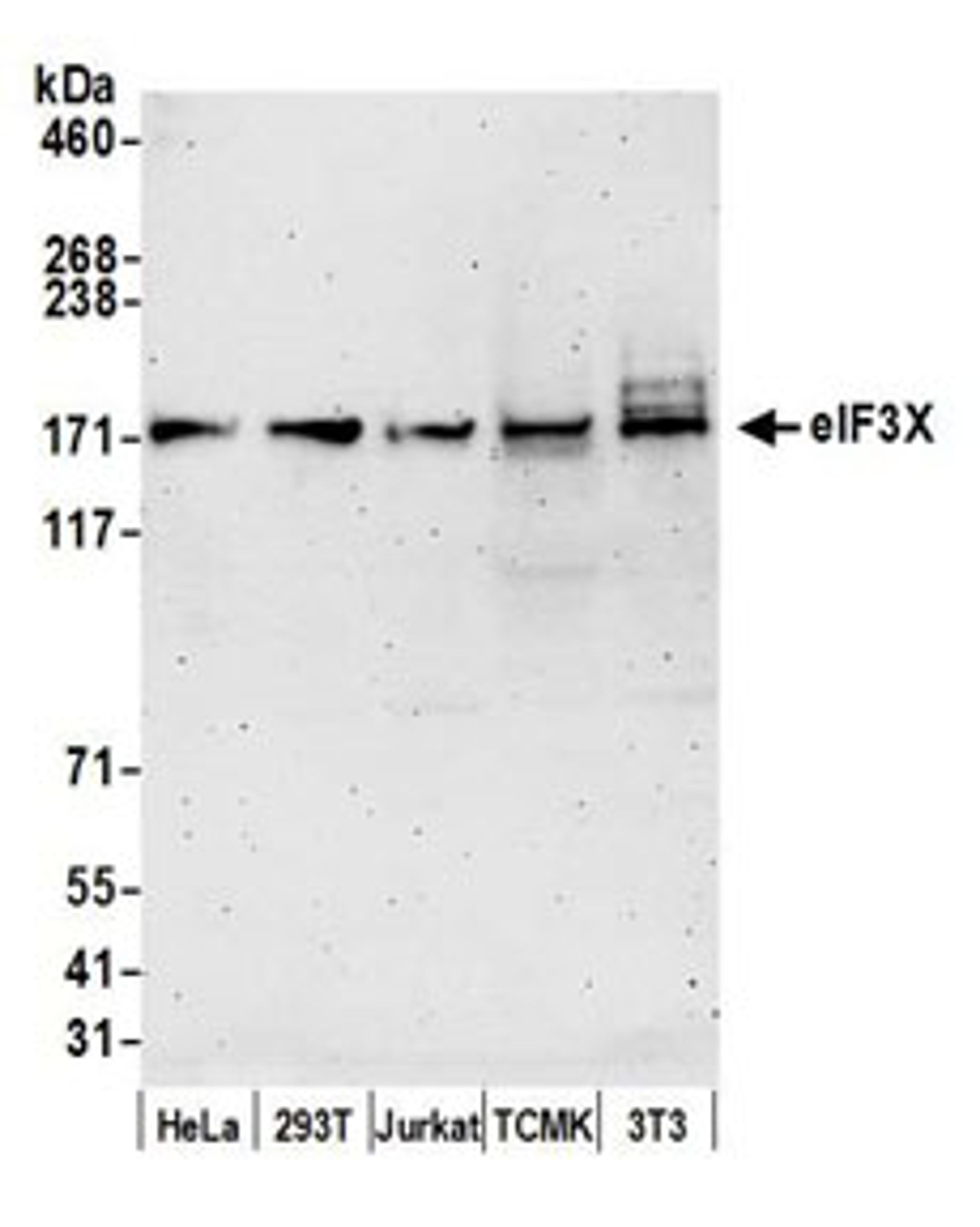 Detection of human and mouse eIF3X by western blot.