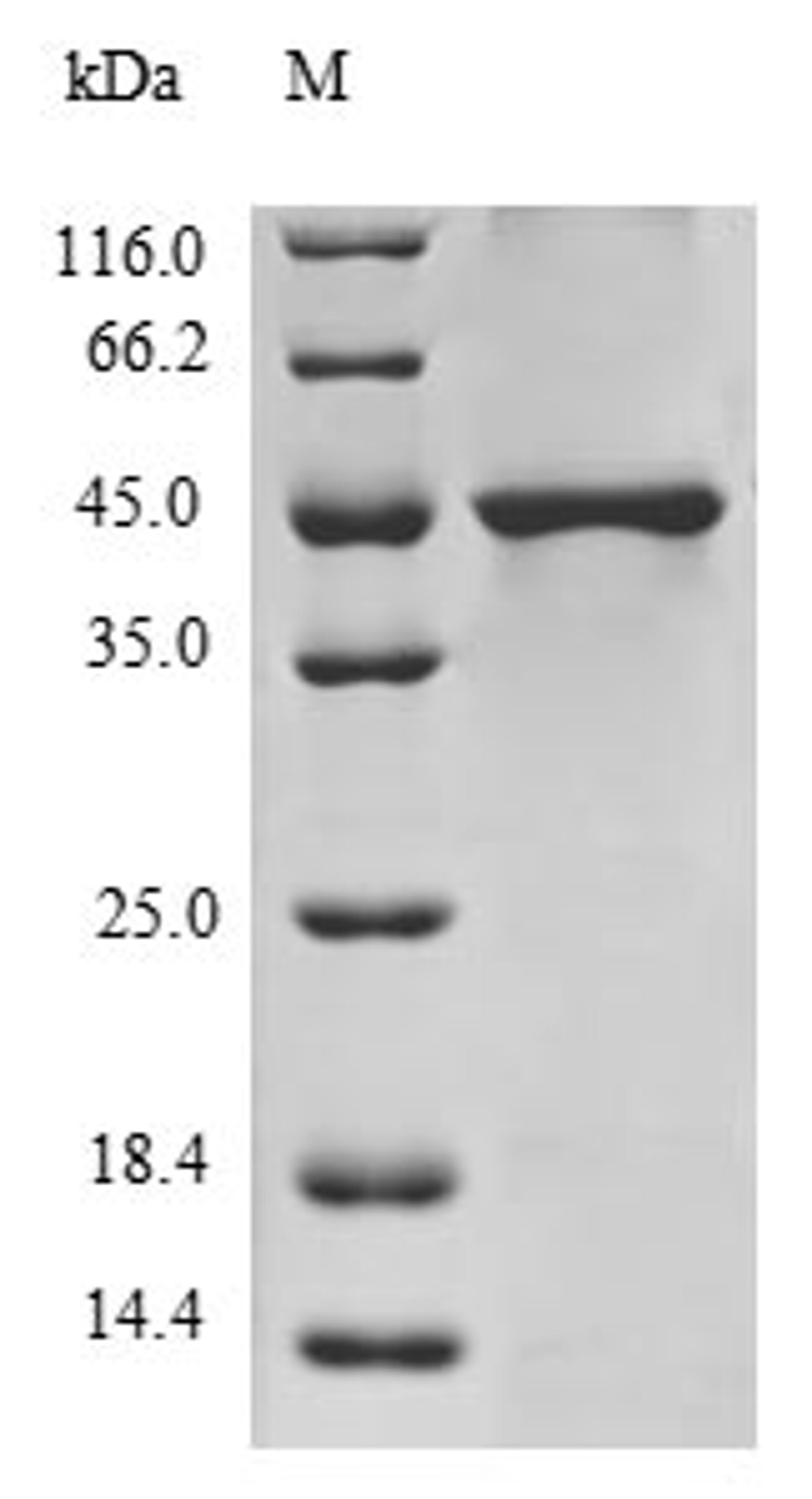 (Tris-Glycine gel) Discontinuous SDS-PAGE (reduced) with 5% enrichment gel and 15% separation gel.