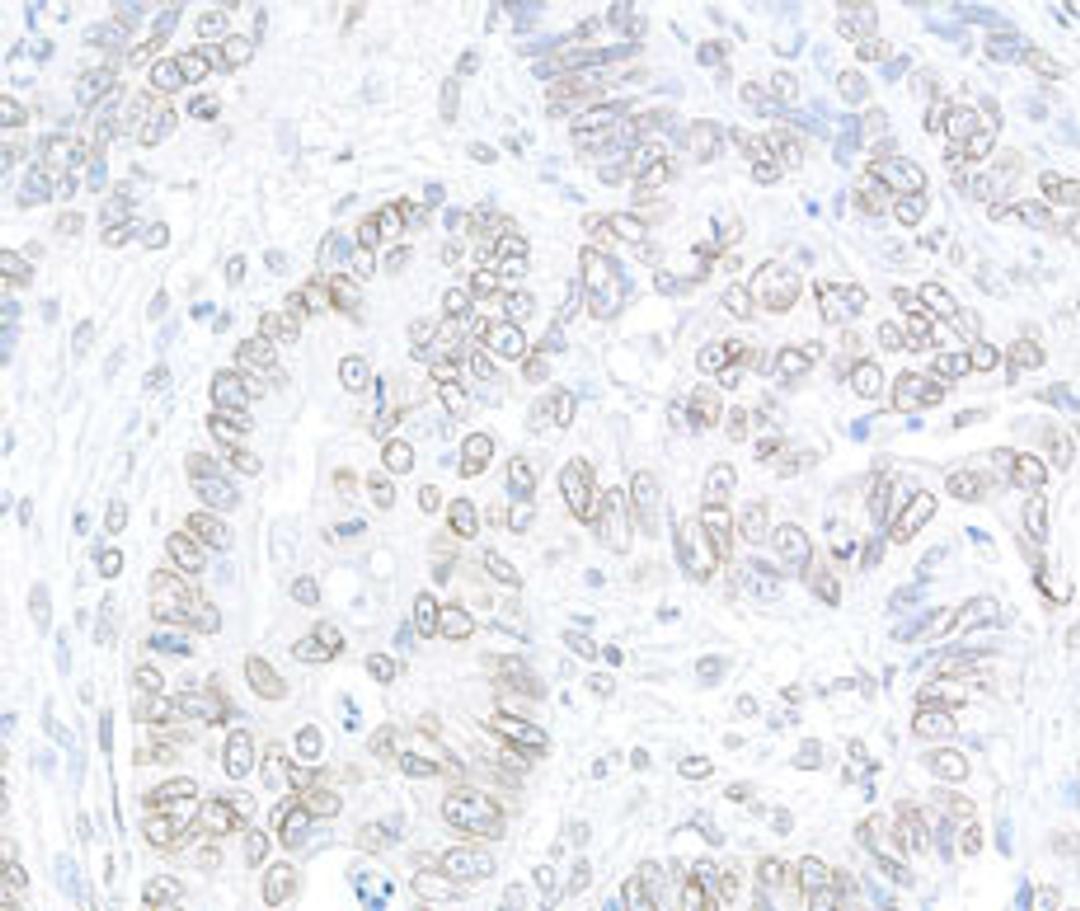 Detection of human TPR by immunohistochemistry.