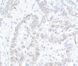 Detection of human TPR by immunohistochemistry.