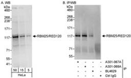 Detection of human RBM25/RED120 by western blot and immunoprecipitation.