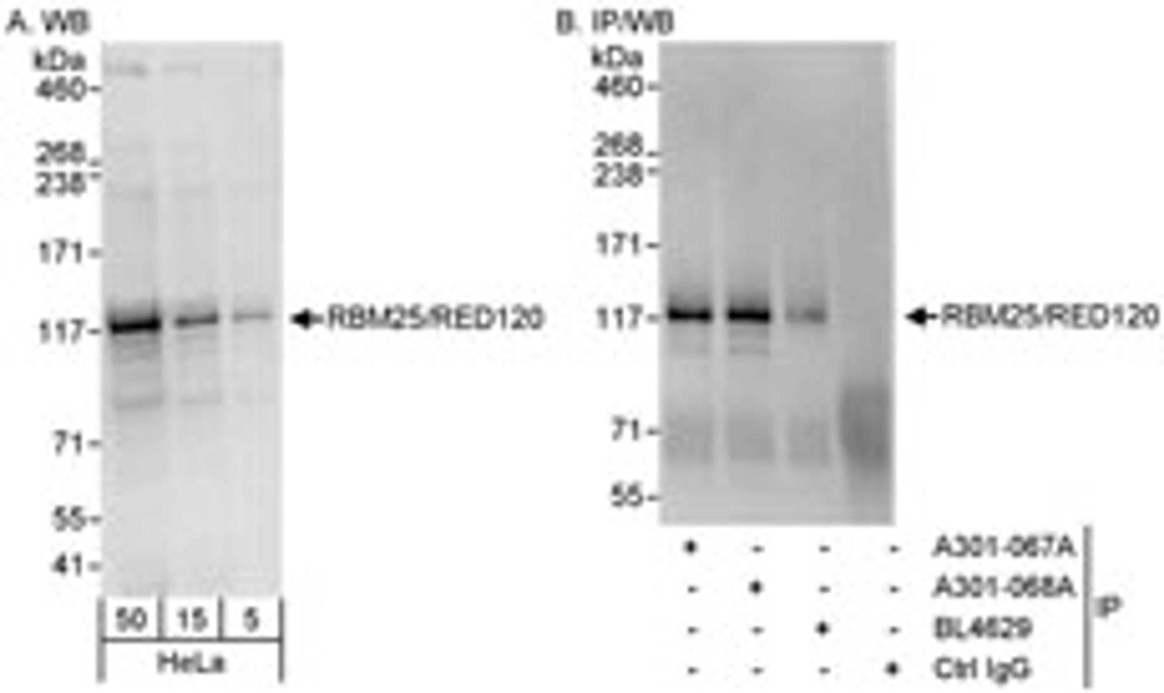 Detection of human RBM25/RED120 by western blot and immunoprecipitation.