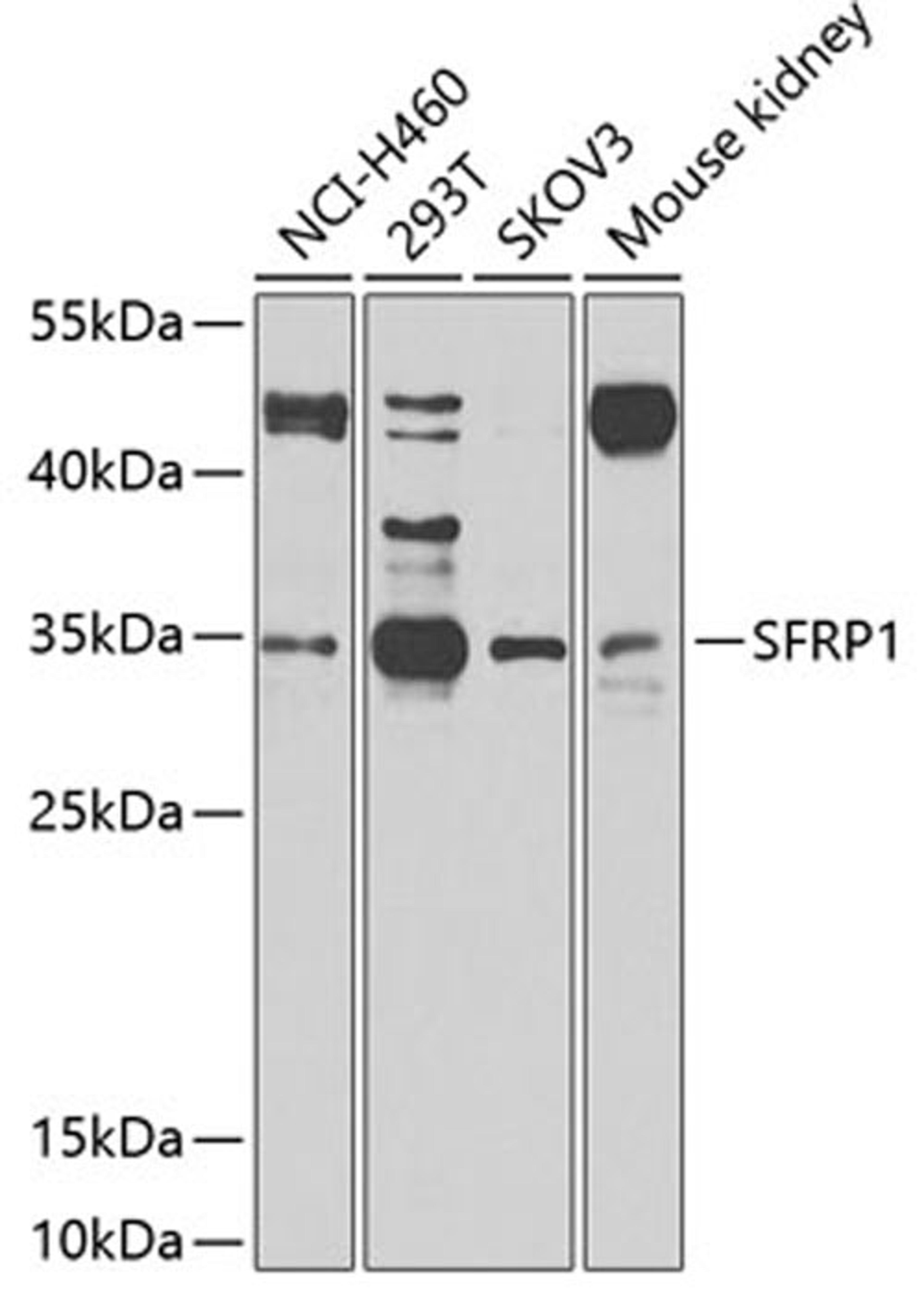 Western blot - SFRP1 antibody (A2911)