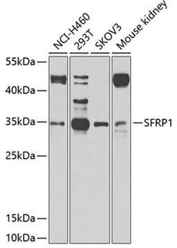 Western blot - SFRP1 antibody (A2911)