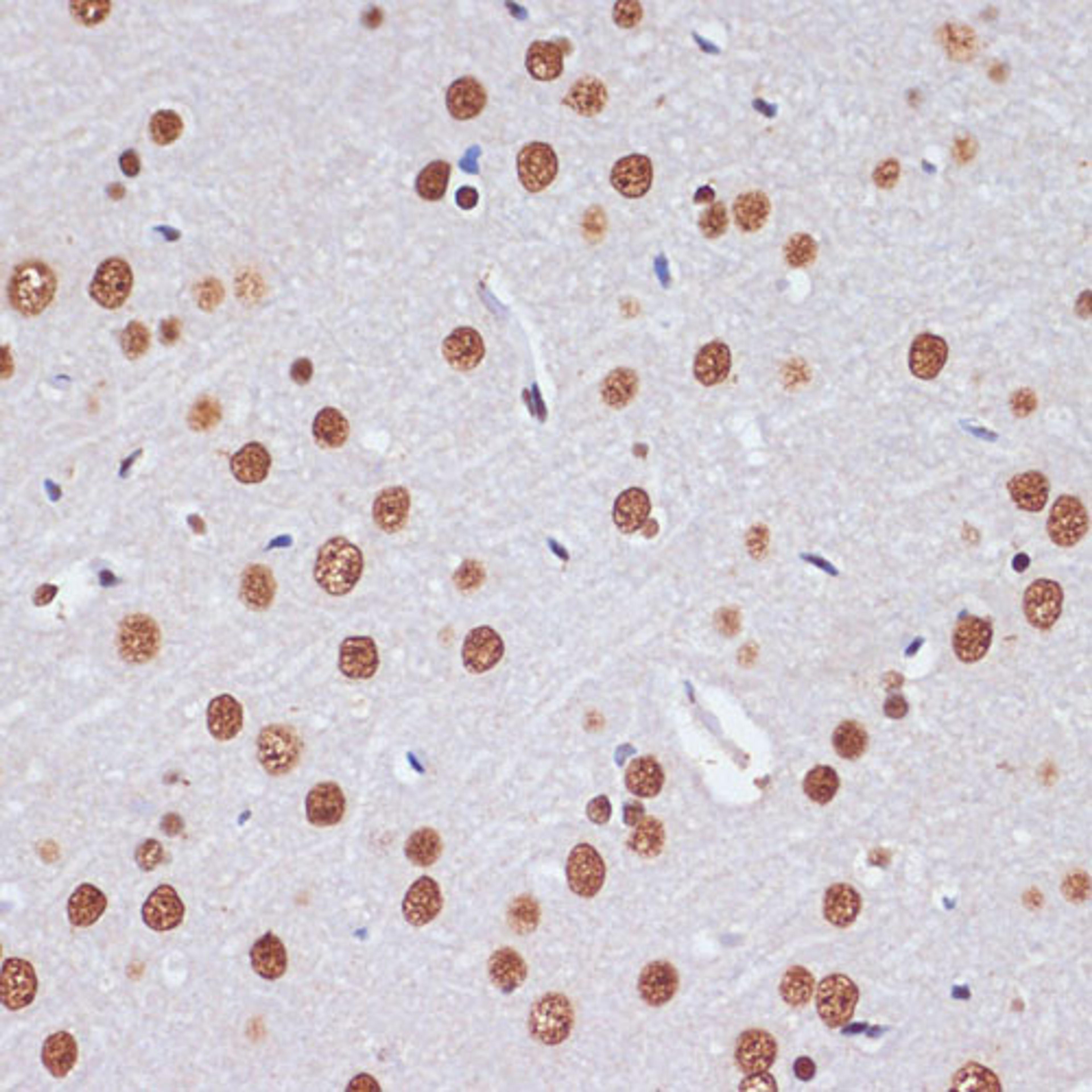 Immunohistochemistry  - PELP1 antibody (A13414)