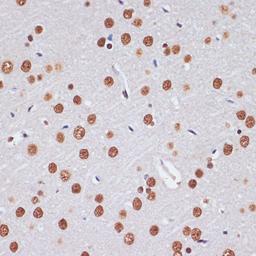 Immunohistochemistry - PELP1 antibody (A13414)