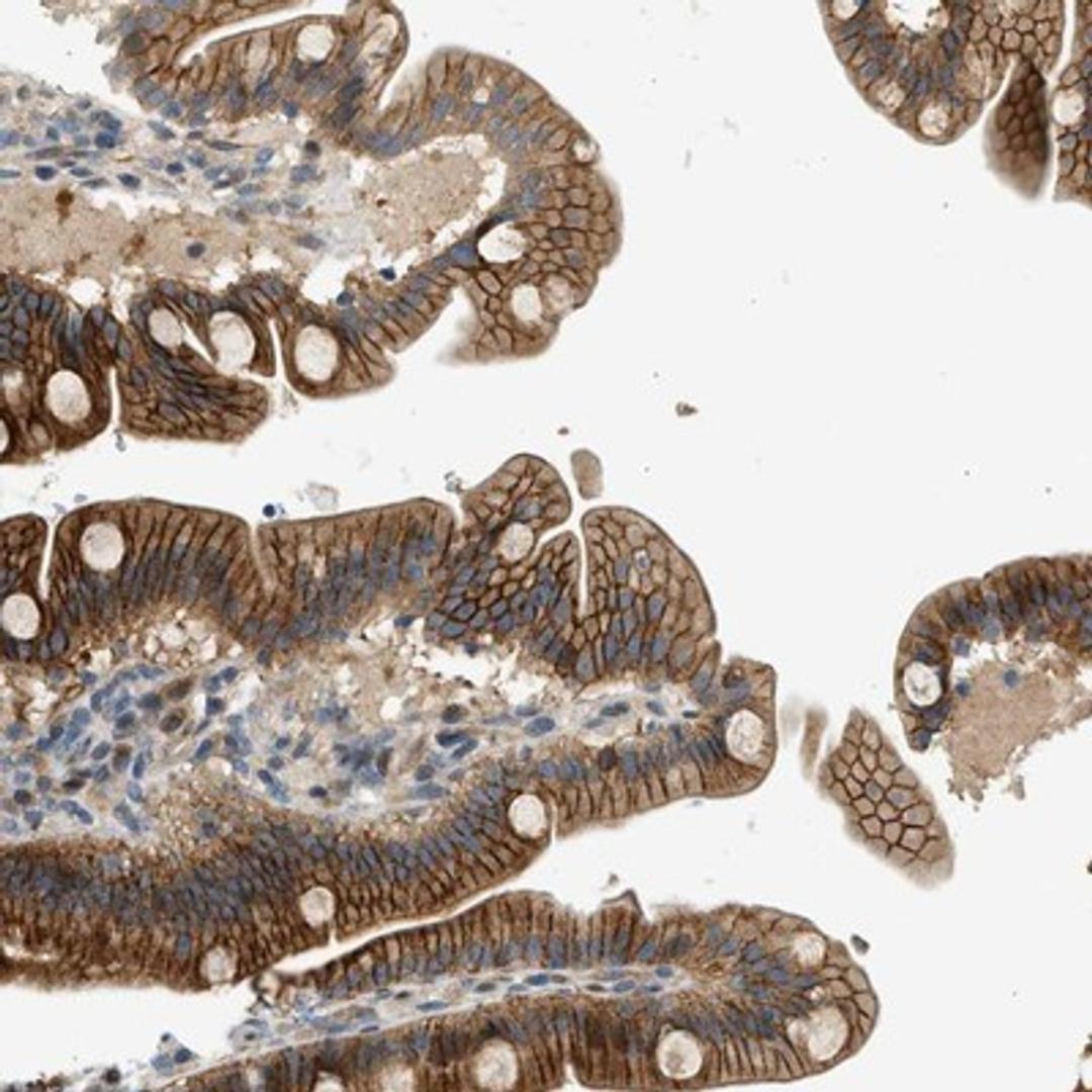 Immunohistochemistry-Paraffin: NRSN2 Antibody [NBP1-88290] - Staining of human duodenum shows cytoplasmic and membranous positivity in glandular cells.