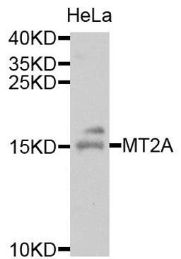 Western blot analysis of extracts of HeLa cells using MT2A antibody