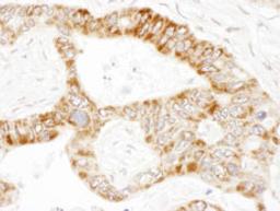 Detection of human PCCA by immunohistochemistry.