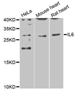 Western blot analysis of extracts of various cell lines, using IL6 antibody