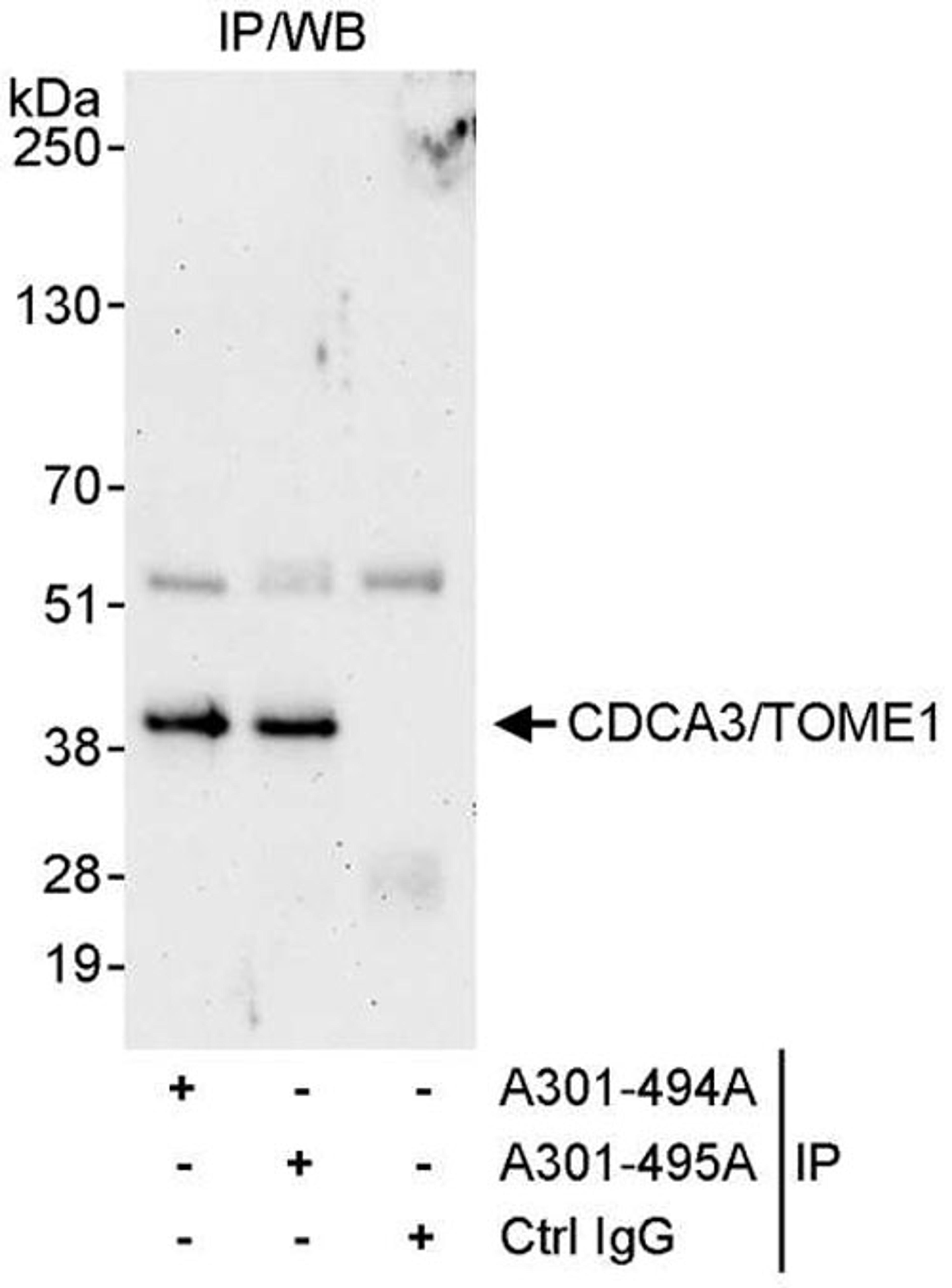 Detection of human CDCA3/TOME1 by WB of IP.