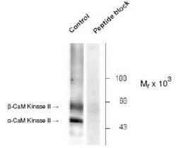 Western Blot: CaMKII alpha [p Thr286] Antibody [NB300-184] - Anaylsis of Rat brain lysate showing specific immunolabeling of the ~50k a- and the ~60k beta-CaM Kinase II phosphorylated at Thr286 (Control). The phosphospecificity of this labeling is shown in the second lane (lambda-phosphatase: lambda-Ptase). The blot is identical to the control except that it was incubated in lambda-Ptase (1200 units for 30 min) before being exposed to the Anti-Thr286 CaM Kinase II. The immunolabeling is completely eliminated by treatment with lambda-Ptase.