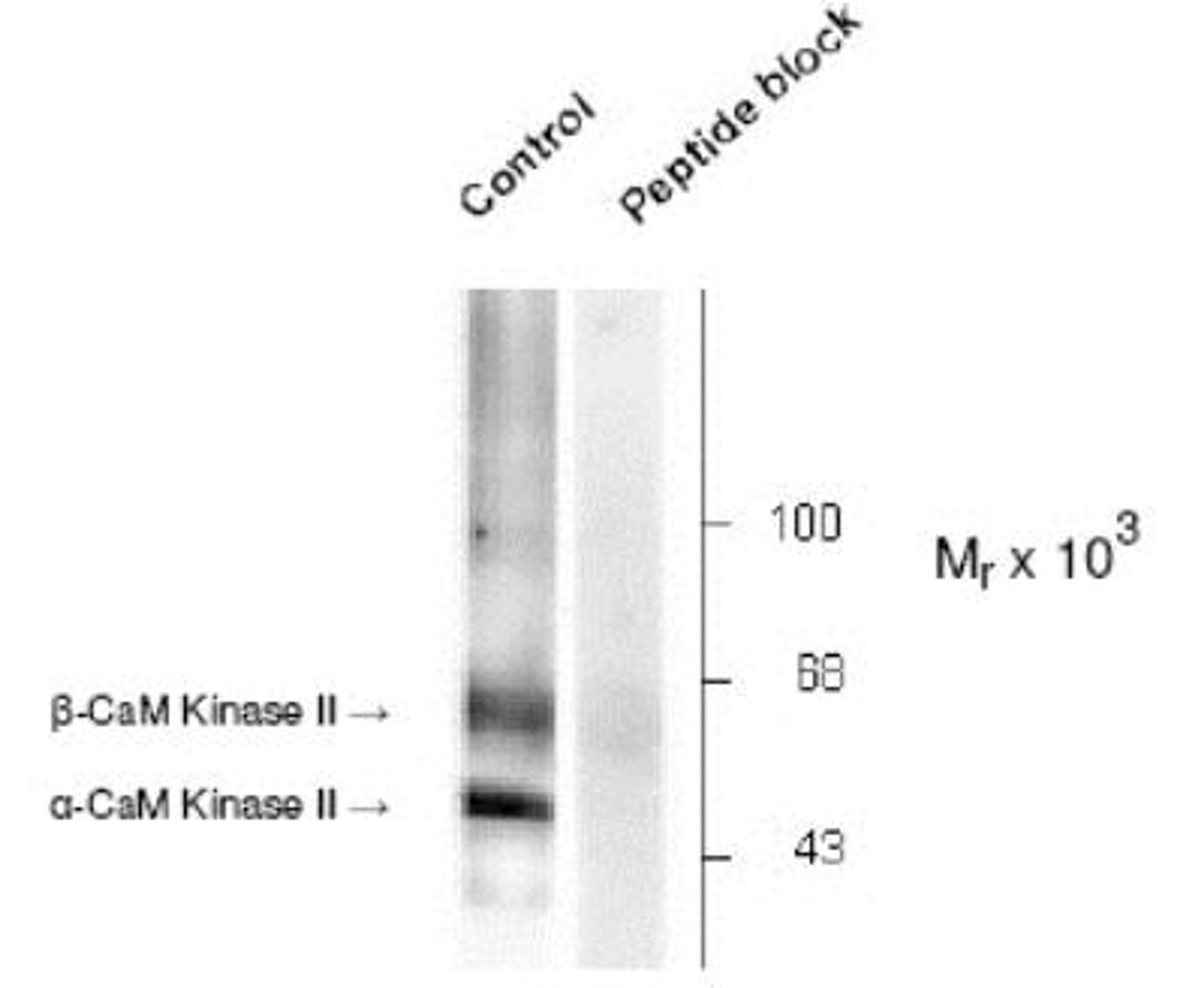 Western Blot: CaMKII alpha [p Thr286] Antibody [NB300-184] - Anaylsis of Rat brain lysate showing specific immunolabeling of the ~50k a- and the ~60k beta-CaM Kinase II phosphorylated at Thr286 (Control). The phosphospecificity of this labeling is shown in the second lane (lambda-phosphatase: lambda-Ptase). The blot is identical to the control except that it was incubated in lambda-Ptase (1200 units for 30 min) before being exposed to the Anti-Thr286 CaM Kinase II. The immunolabeling is completely eliminated by treatment with lambda-Ptase.