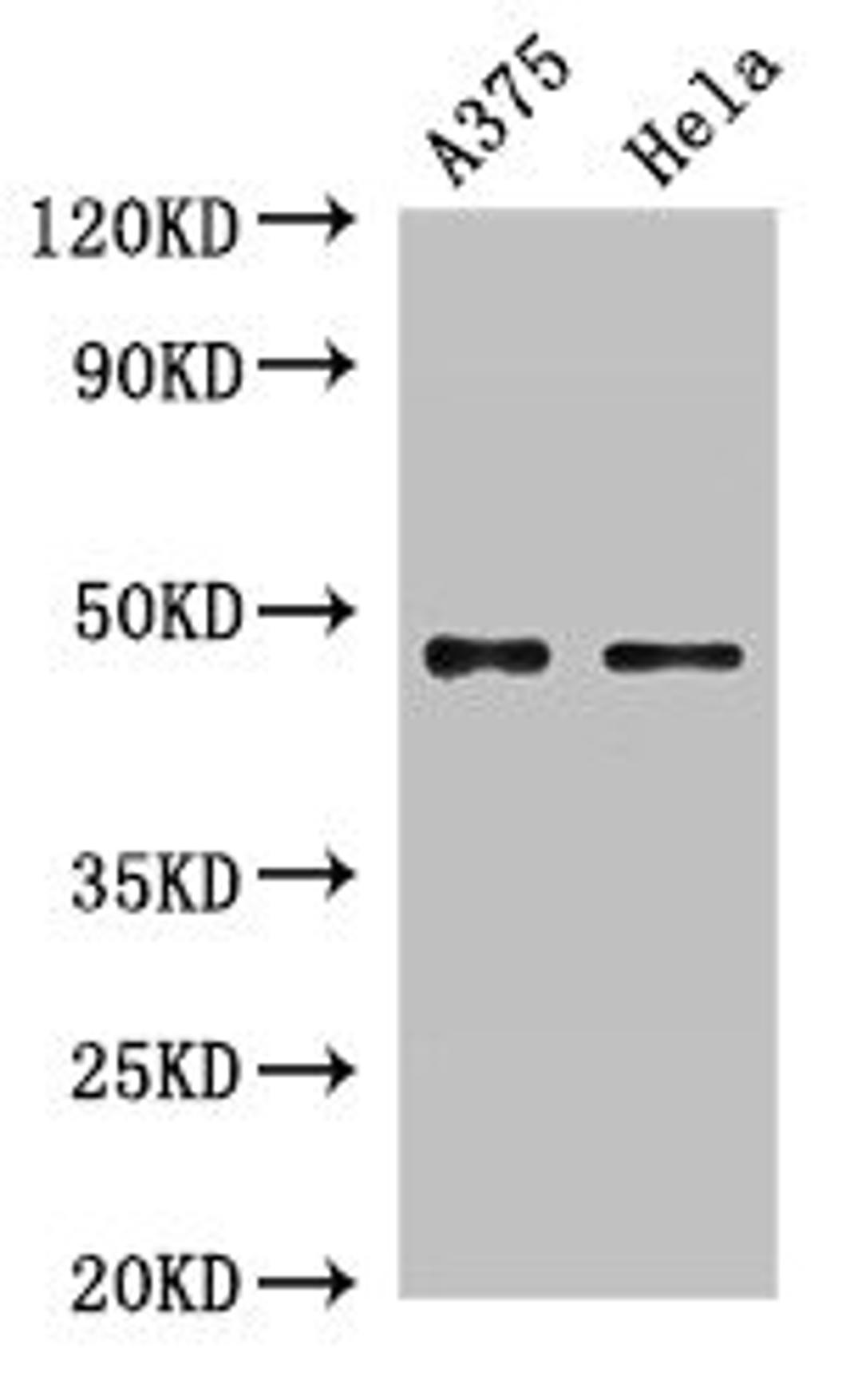 Western Blot. Positive WB detected in: A375 whole cell lysate, Hela whole cell lysate. All lanes: RPL4 antibody at 2µg/ml. Secondary. Goat polyclonal to rabbit IgG at 1/50000 dilution. Predicted band size: 48 kDa. Observed band size: 48 kDa