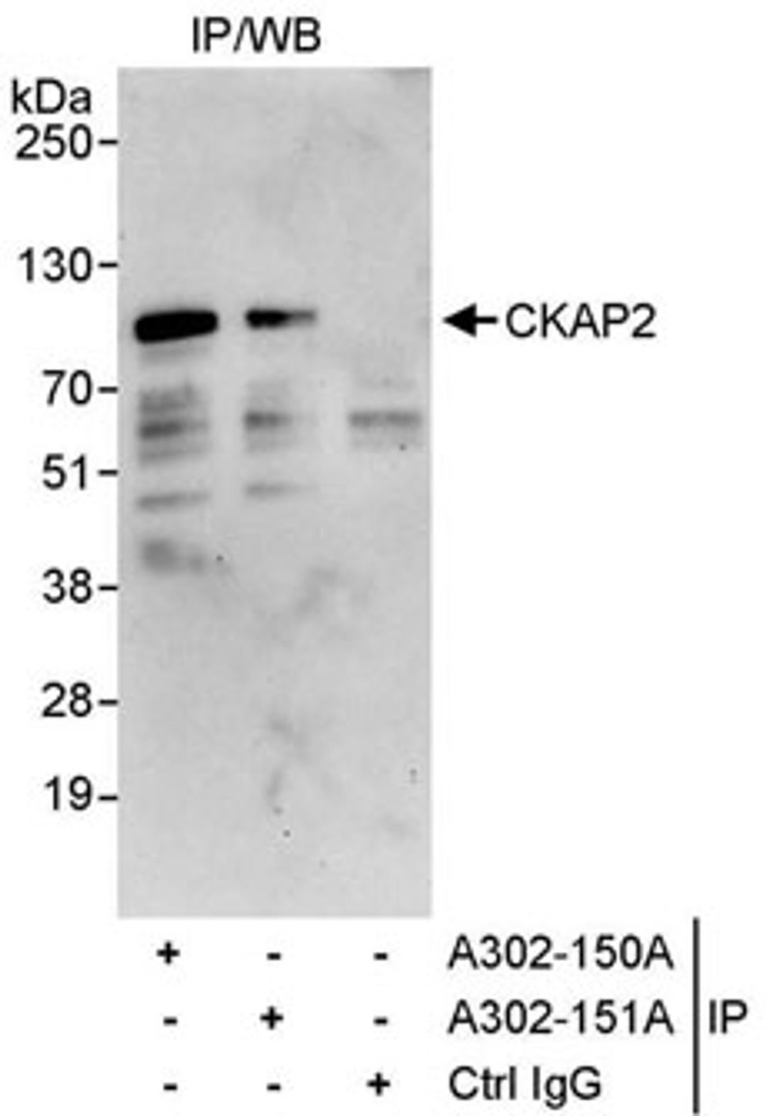 Detection of human CKAP2 by western blot of immunoprecipitates.