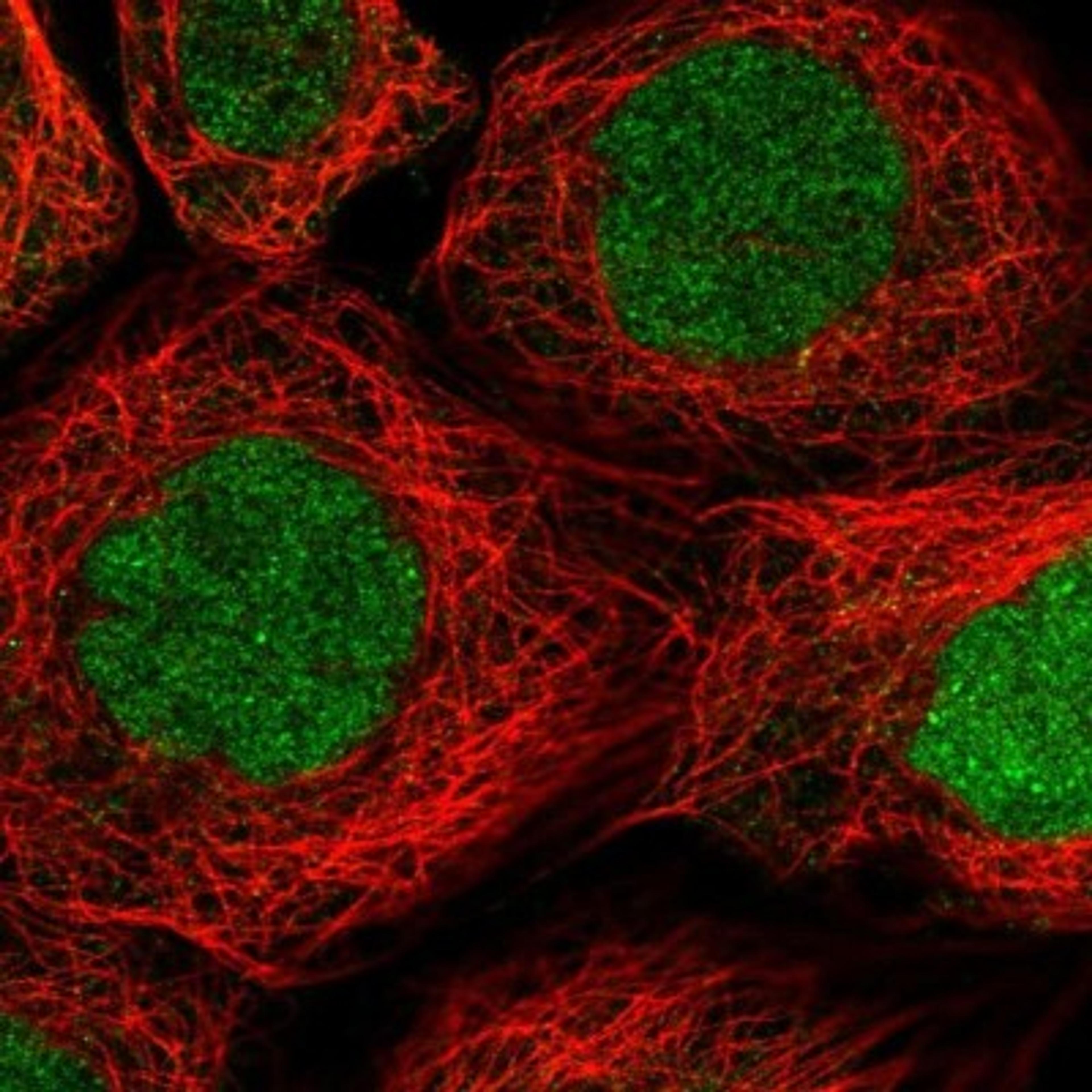 Immunocytochemistry/Immunofluorescence: RAD51AP1 Antibody [NBP2-13197] - Staining of human cell line A-431 shows positivity in nucleus but not nucleoli.