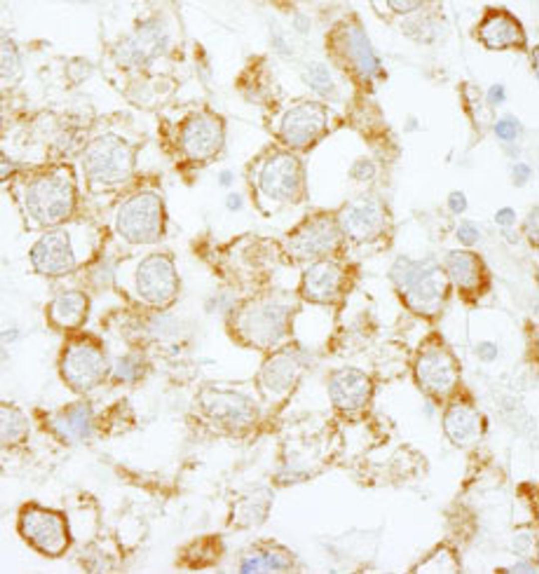 Detection of human eIF4H by immunohistochemistry.