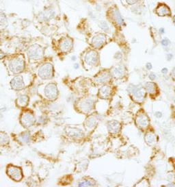 Detection of human eIF4H by immunohistochemistry.