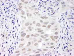 Detection of human EMSY by immunohistochemistry.