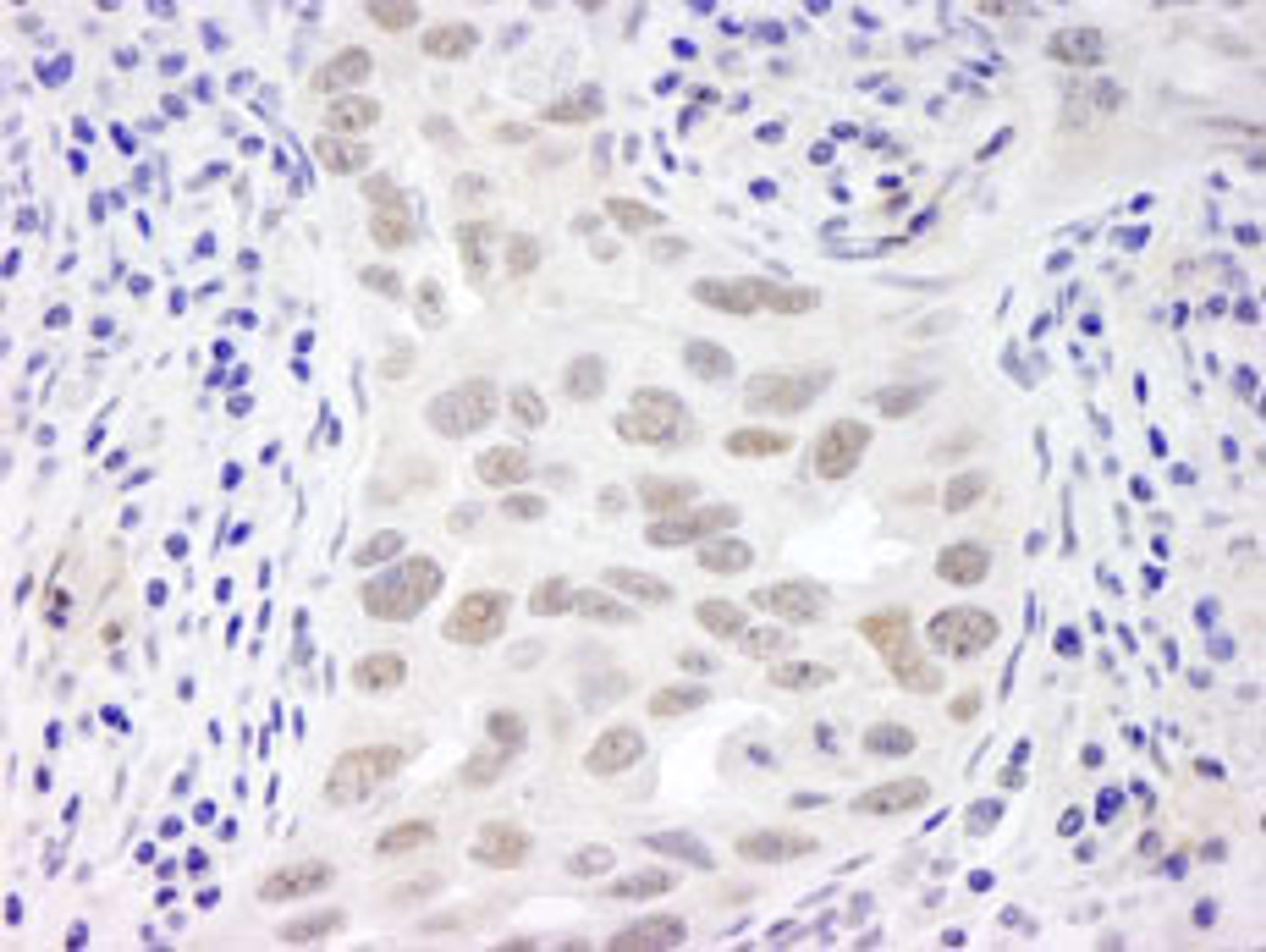 Detection of human EMSY by immunohistochemistry.