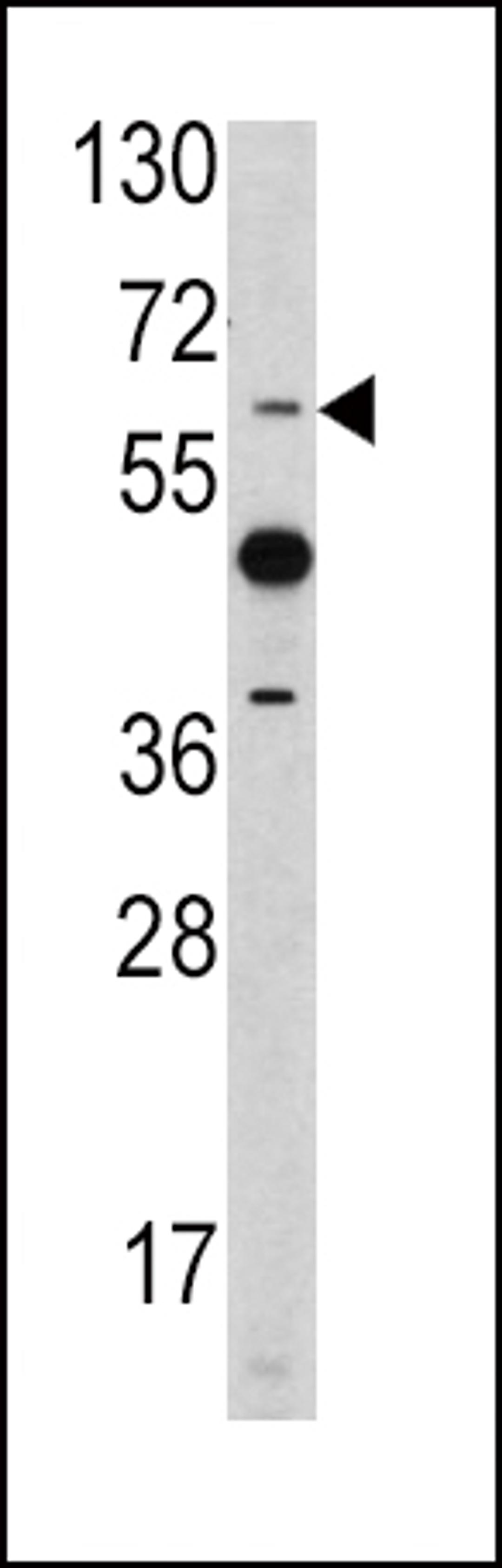 Western blot analysis of ETV4 antibody in mouse heart tissue lysates (35ug/lane)