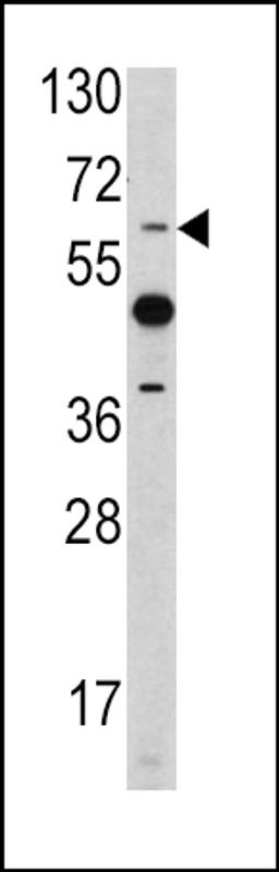 Western blot analysis of ETV4 antibody in mouse heart tissue lysates (35ug/lane)