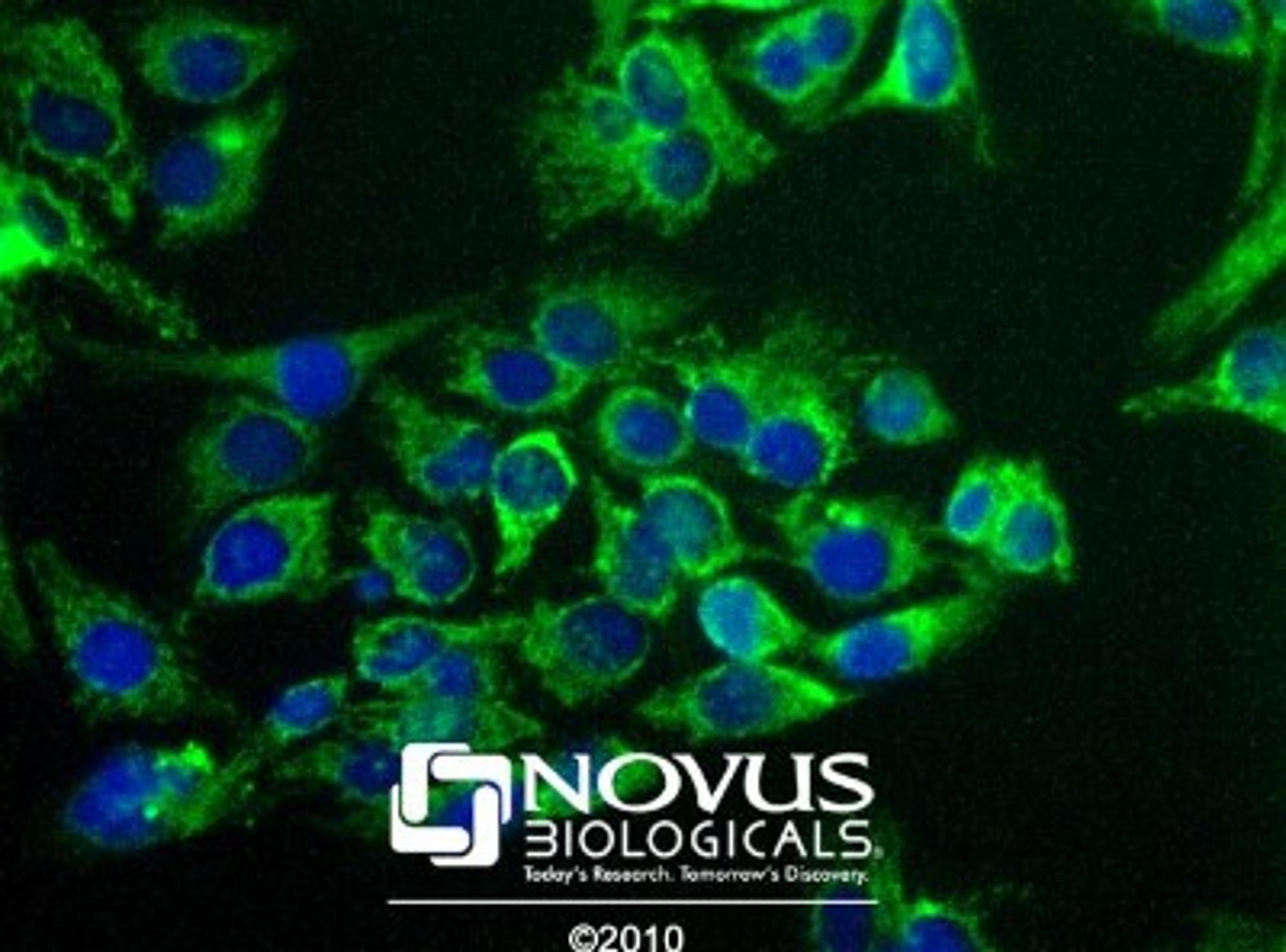 Immunocytochemistry/Immunofluorescence: Pyruvate Carboxylase Antibody [NBP1-49536] - Immunocytochemistry of Pyruvate Carboxylase in HeLa using NBP1-49536. Nuclei (Blue) are counterstained using Hoechst 33258.