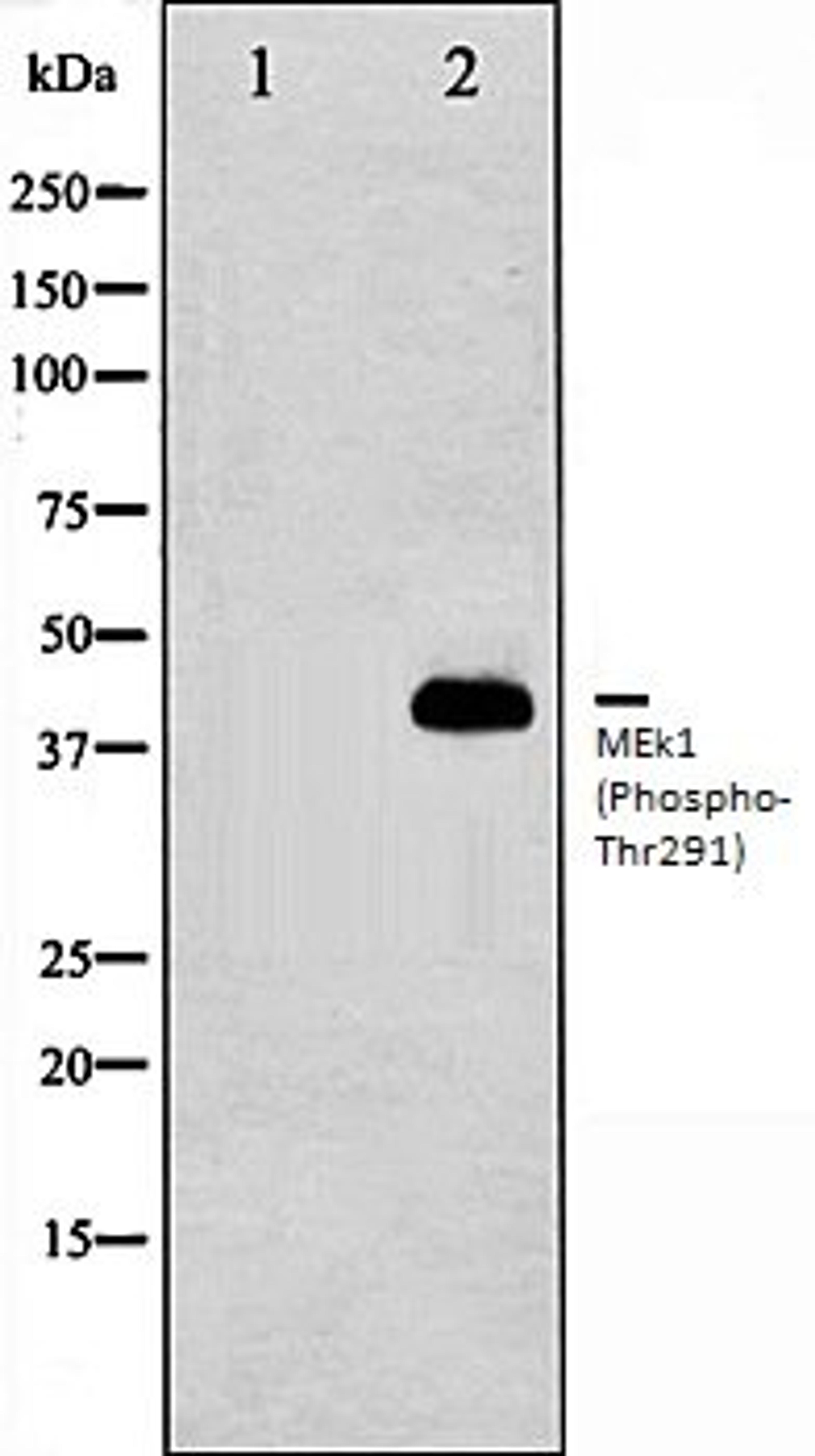 Western blot analysis of K562 whole cell lysates using MEK1 (Phospho-Thr291) antibody, The lane on the left is treated with the antigen-specific peptide.