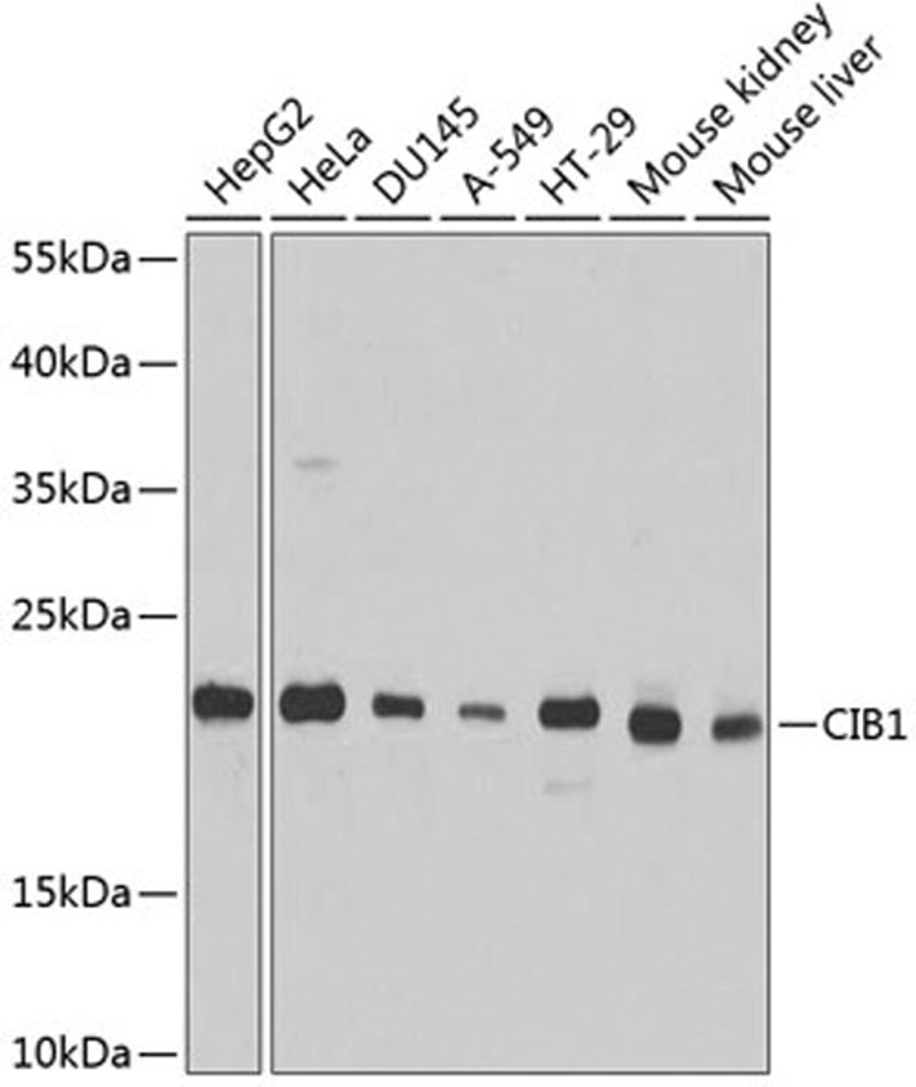 Western blot - CIB1 antibody (A4430)