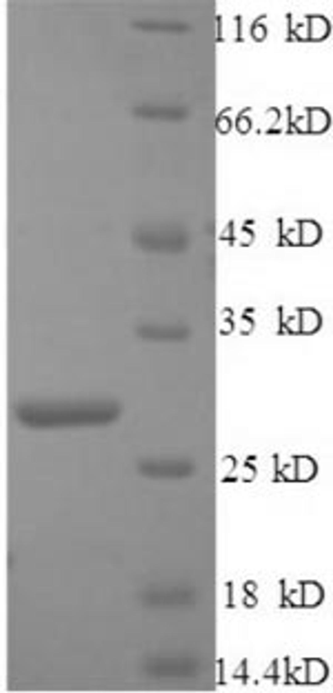 (Tris-Glycine gel) Discontinuous SDS-PAGE (reduced) with 5% enrichment gel and 15% separation gel.