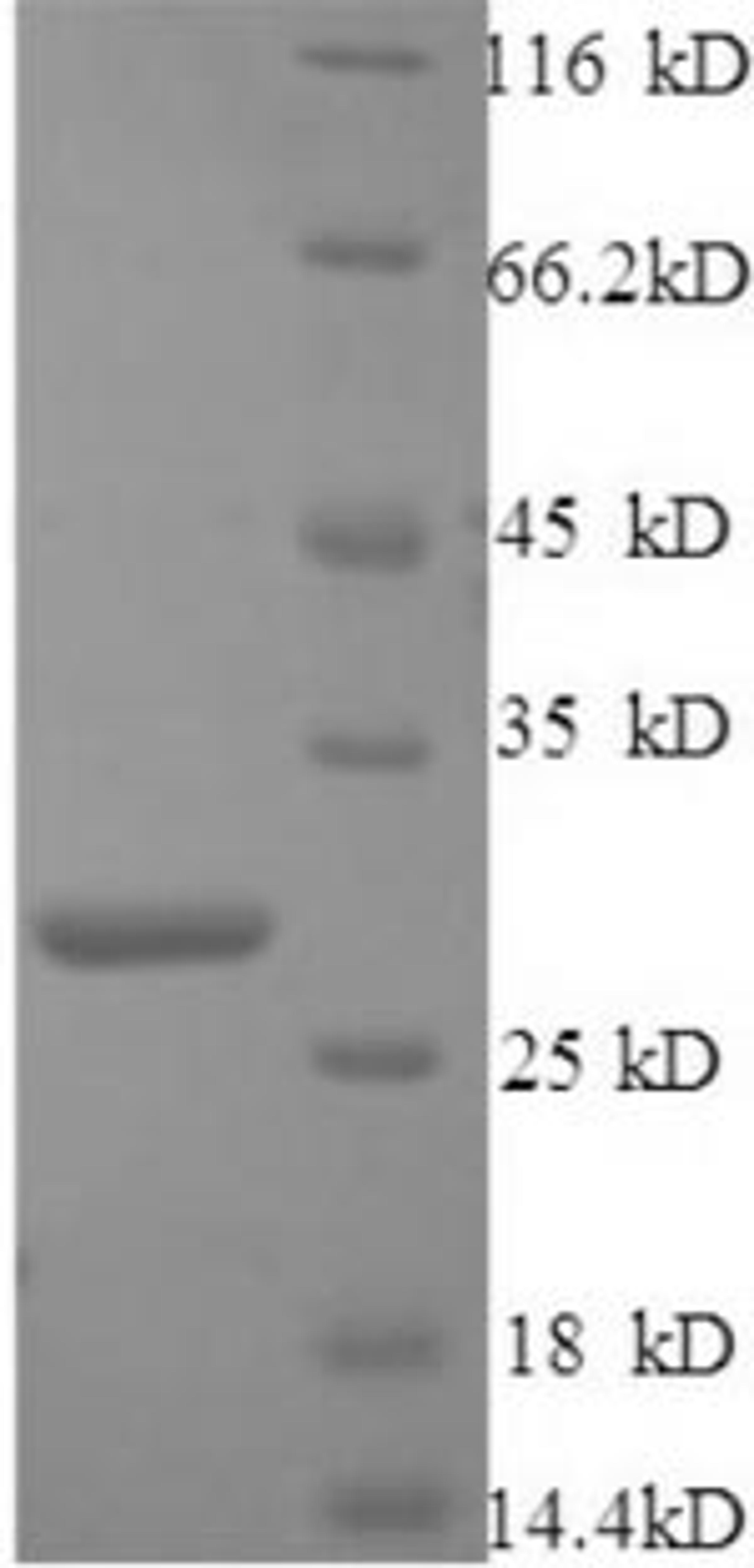 (Tris-Glycine gel) Discontinuous SDS-PAGE (reduced) with 5% enrichment gel and 15% separation gel.