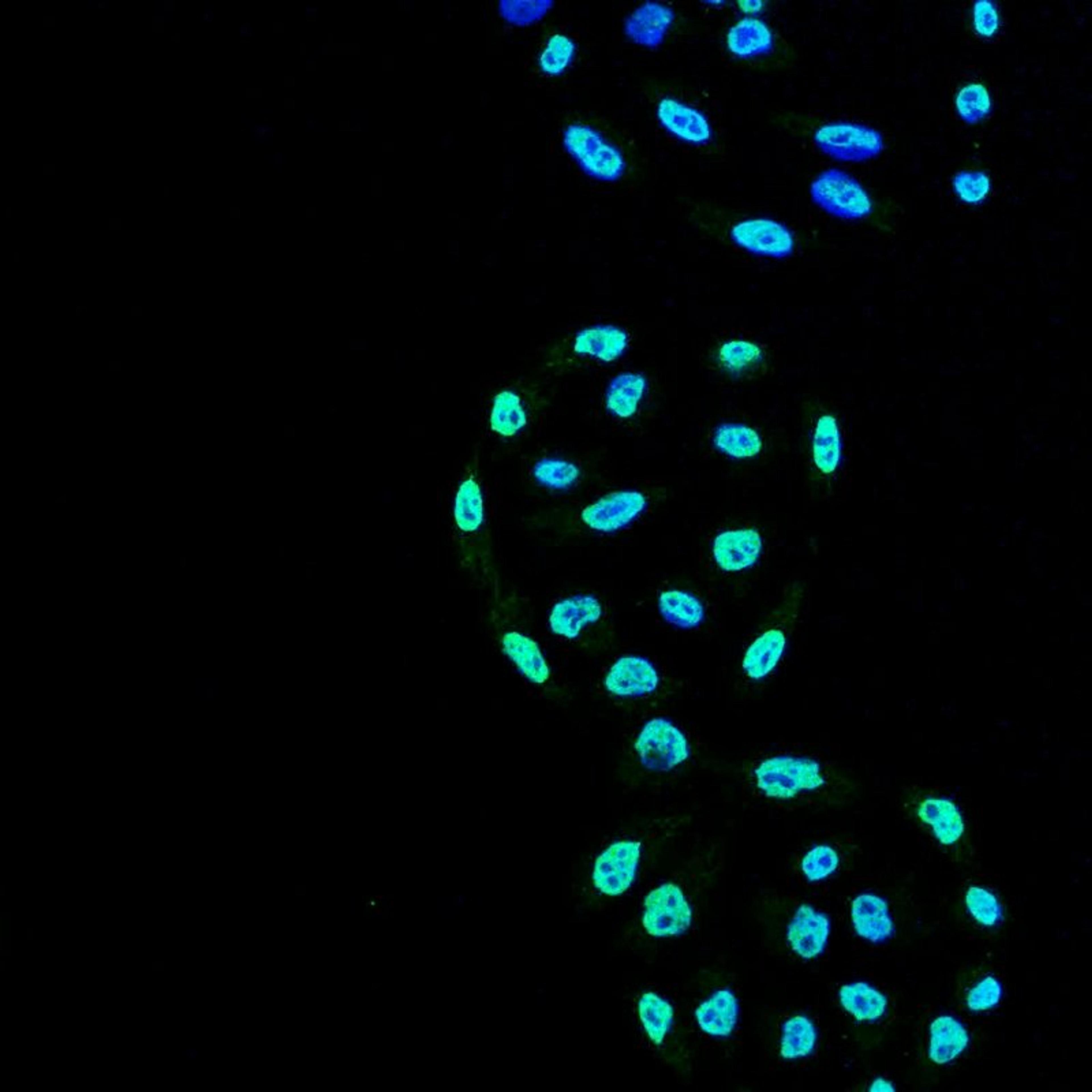 Immunofluorescence analysis of cervical cancer cell line (hela) using PP5 antibody