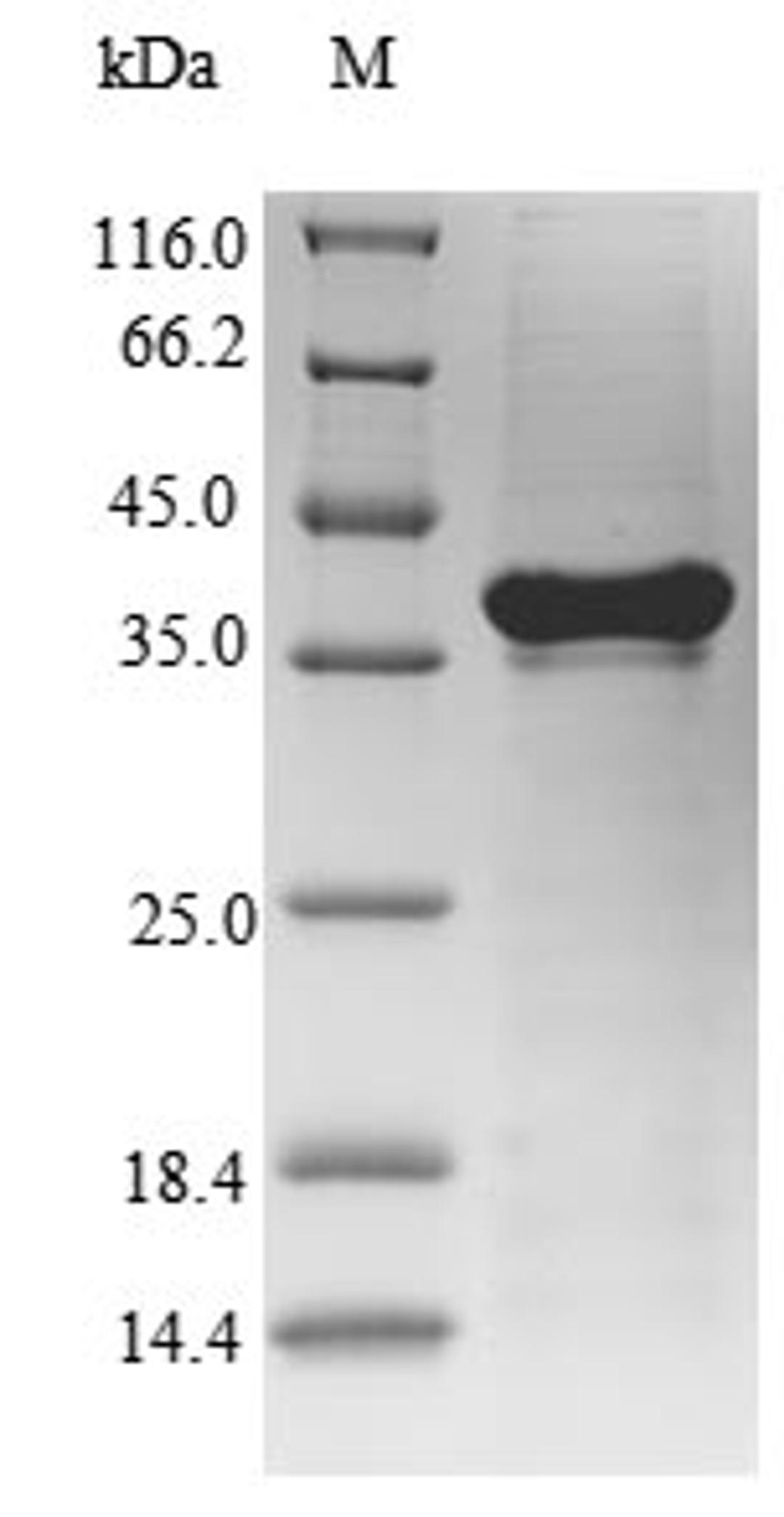(Tris-Glycine gel) Discontinuous SDS-PAGE (reduced) with 5% enrichment gel and 15% separation gel.