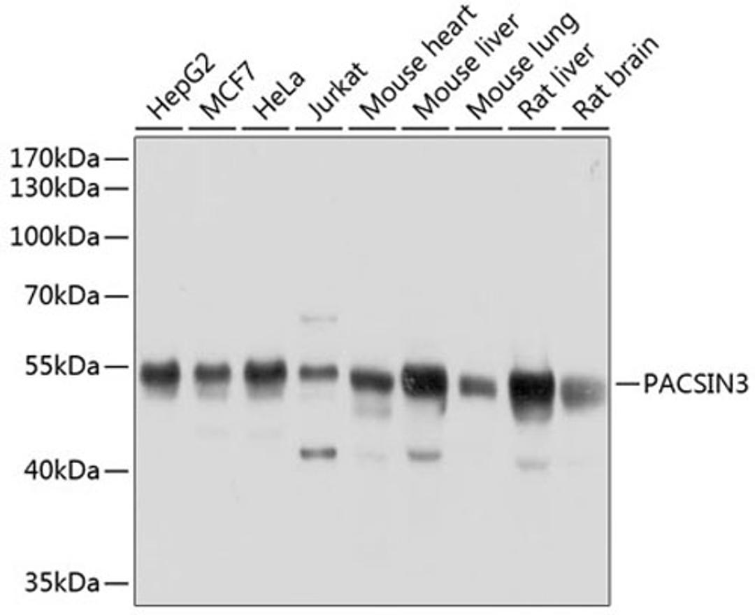 Western blot - PACSIN3 antibody (A8647)